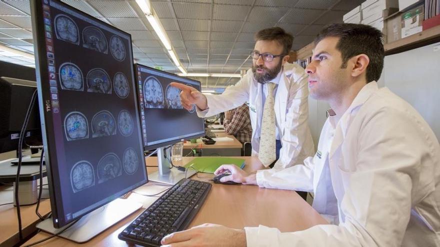 Una singularidad cerebral señala un alto riesgo de tener alzhéimer