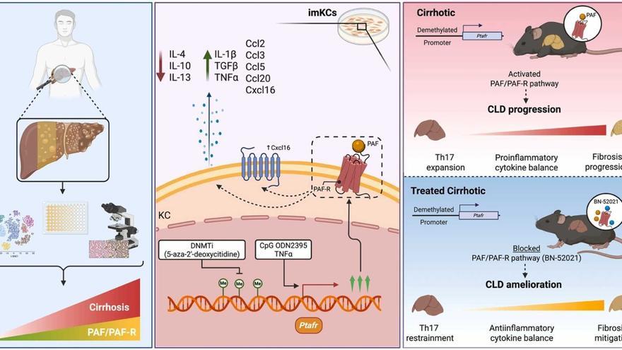 La UMH de Elche descubre una nueva diana terapéutica que mejora la función hepática en pacientes con cirrosis