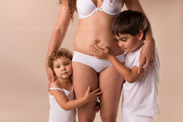 Cuerpo tras el embarazo
