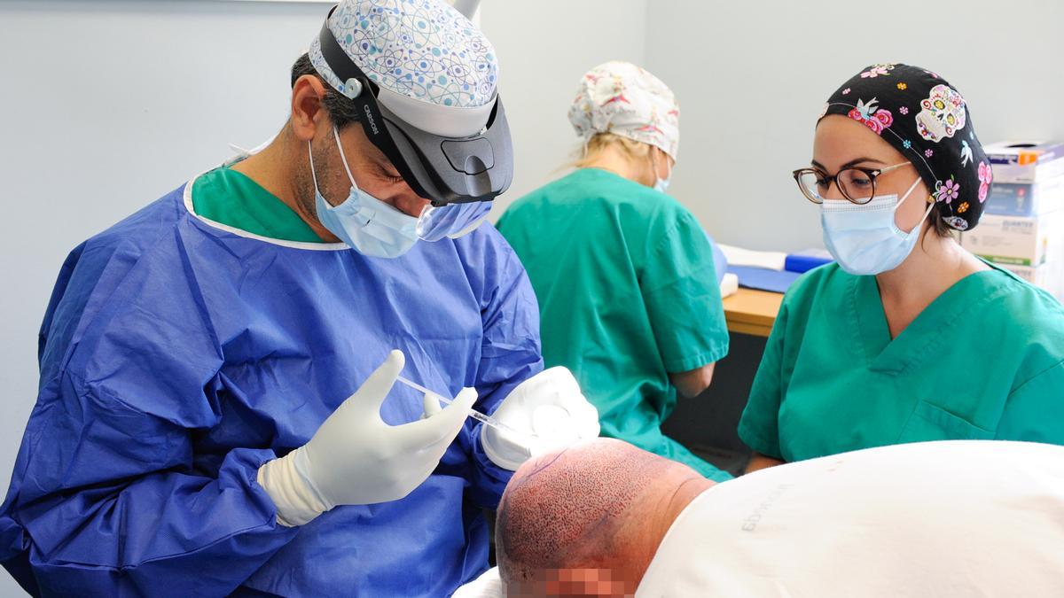 La cirugía capilar una de las soluciones más efectivas contra la alopecia.