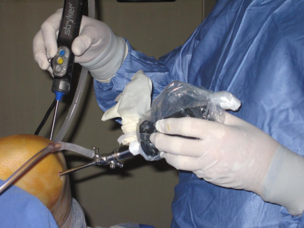 Un doctor interviene una rodilla