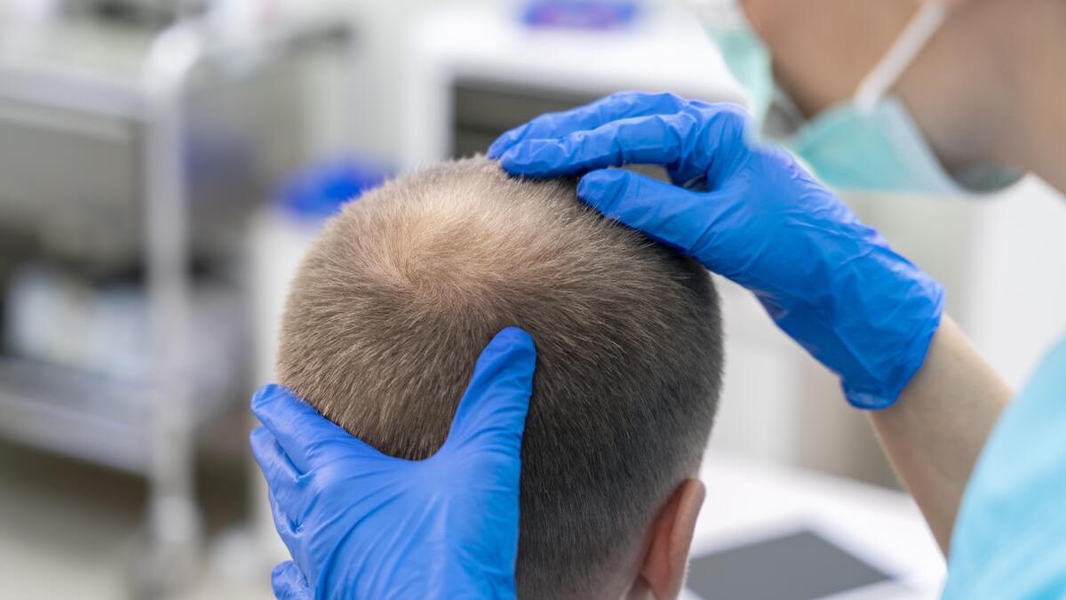 La mayor caída de pelo en otoño no es preocupante, pero si se prolonga en el tiempo se debe acudir a un dermatólogo