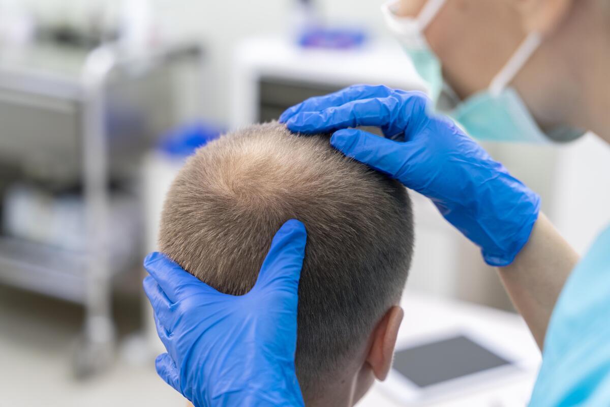 La mayor caída de pelo en otoño no es preocupante, pero si se prolonga en el tiempo se debe acudir a un dermatólogo