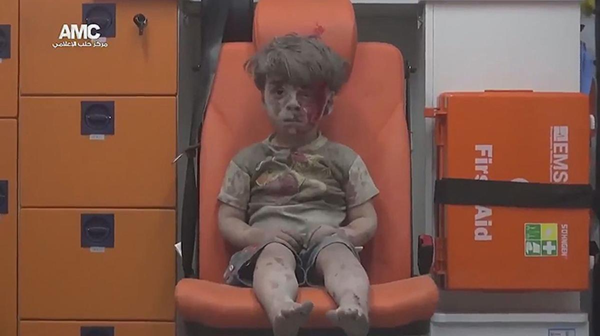 Un nen sirià que sobreviu a un bombardeig espera en una ambulància.