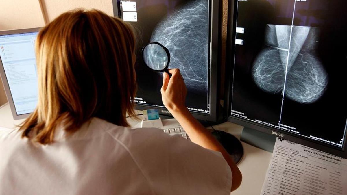 Lectura de una de prueba de mamografía en un hospital valenciano.