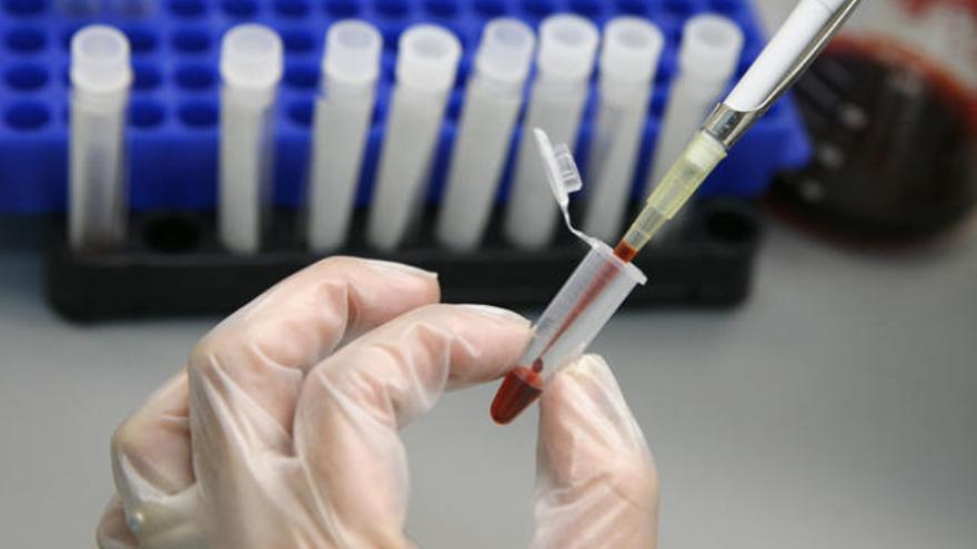 Científicos españoles hallan la molécula que propaga el sida