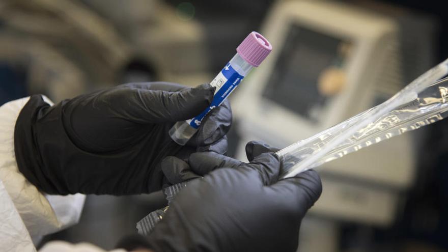 Test del PCR per confirmar si una persona té coronavirus o no