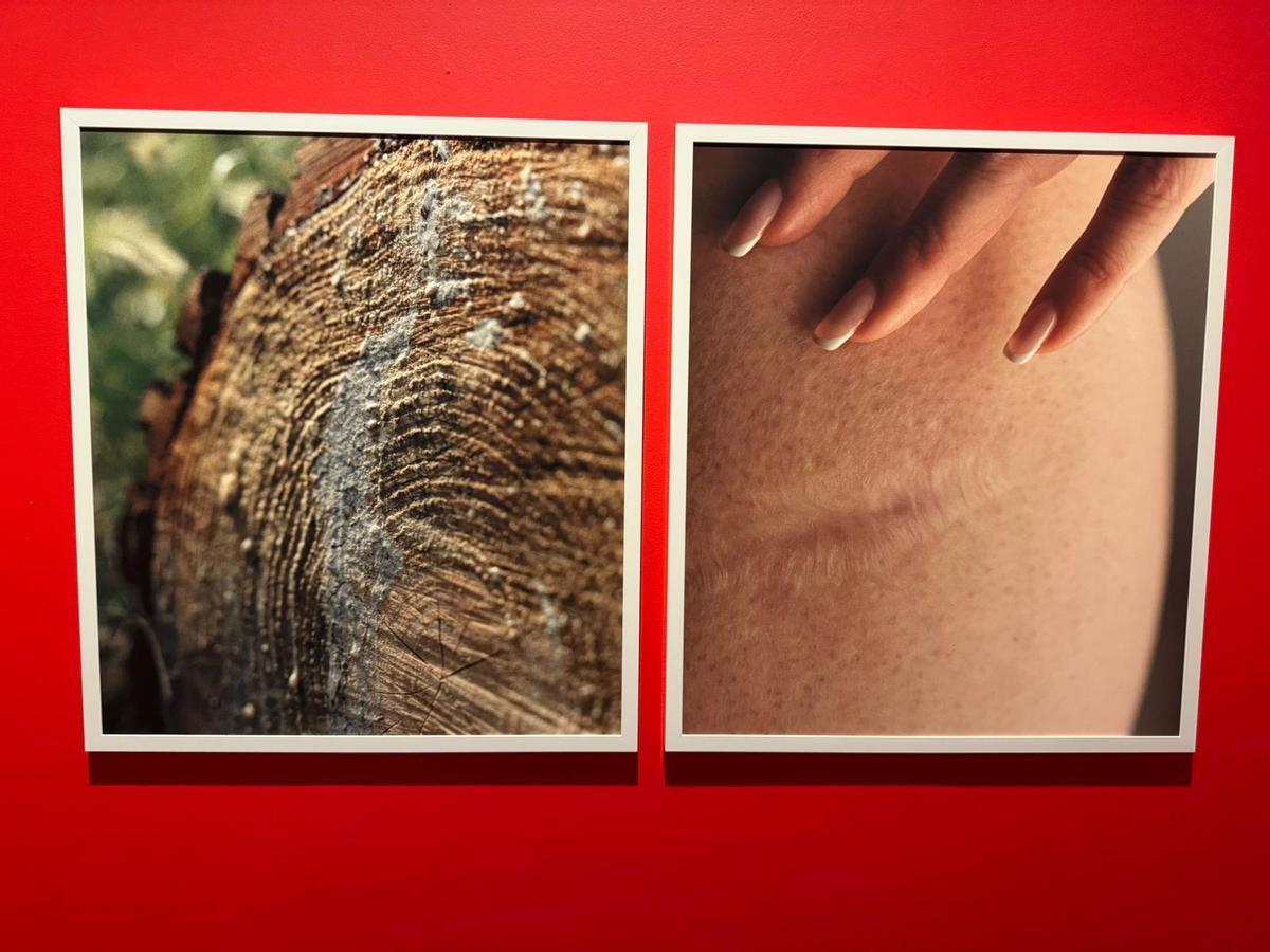 La muestra, que estará disponible hasta el 11 de octubre, contrapone elementos de la naturaleza como un tronco talado y una herida en la piel.