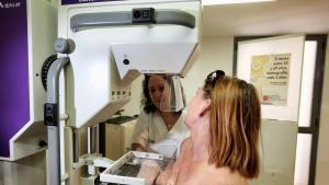 Només el 68% de les dones de 50 a 69 anys s’ha fet una mamografia en els últims dos anys, per sota del 81,5% registrat el 2017