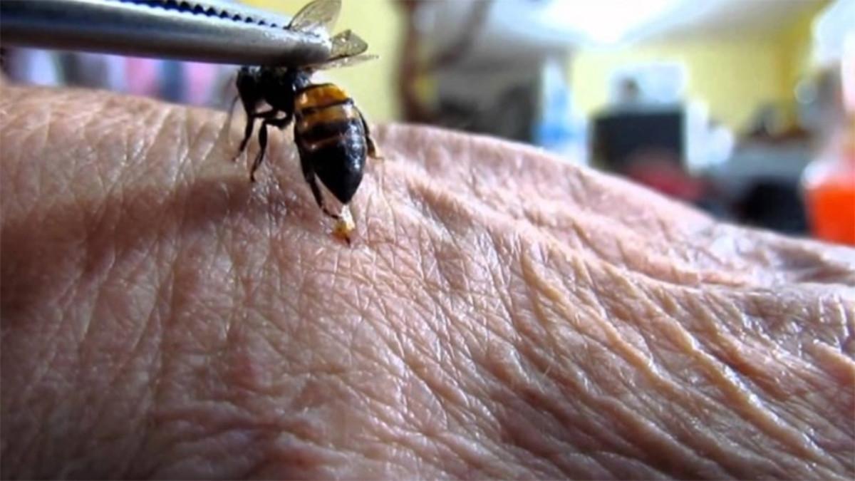 Una mujer fallece tras tratarse con abejas