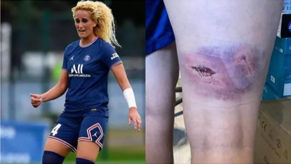 Kheira Hamraoui y una imagen de su lesión.
