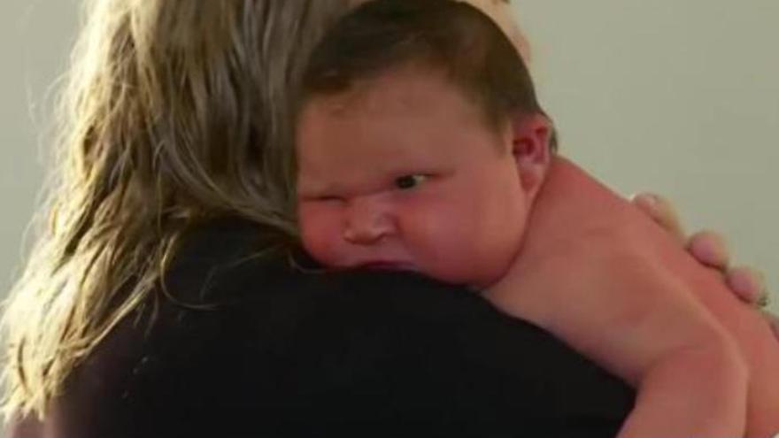 La recién nacida que parece un luchador de sumo