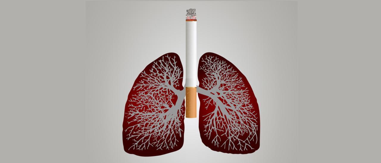 El tabaquismo es una de las principales causas del cáncer de pulmón.