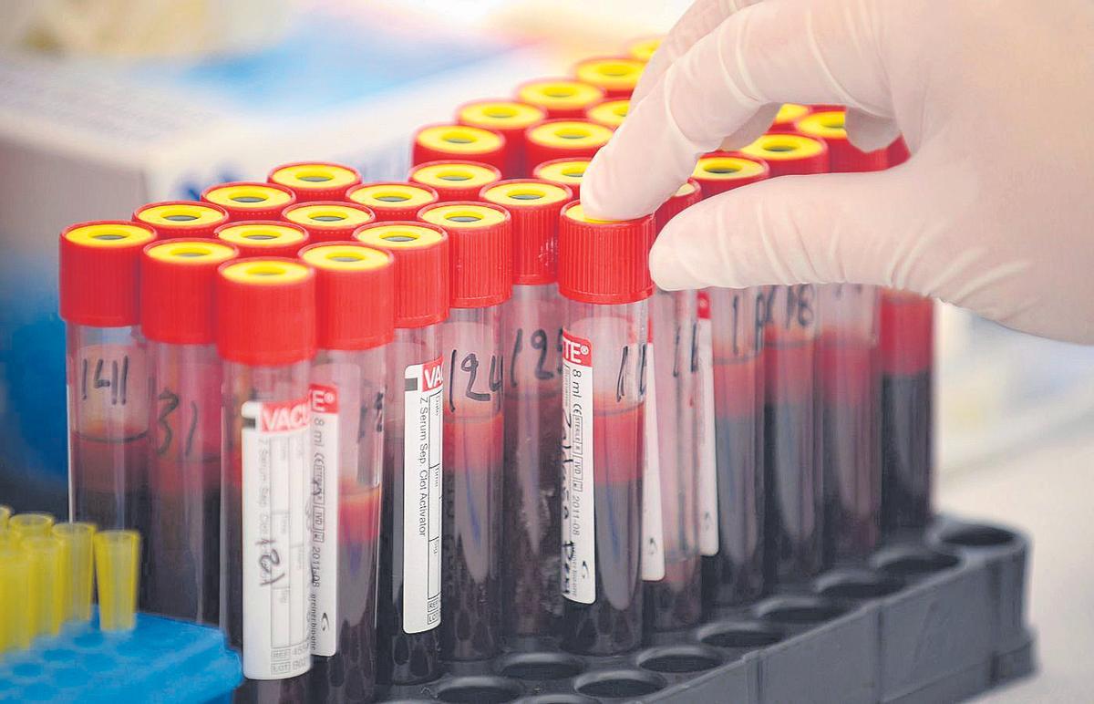 Muestras de sangre en un laboratorio.