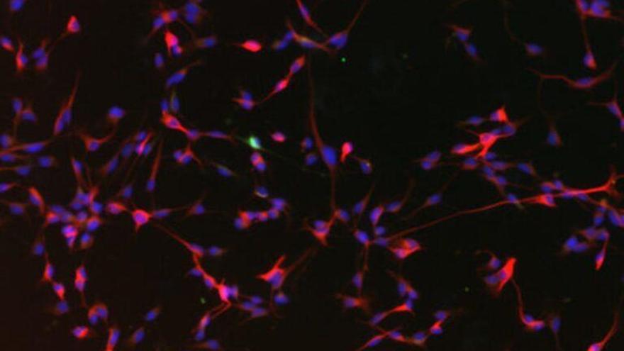 Las frutas regeneran al cerebro