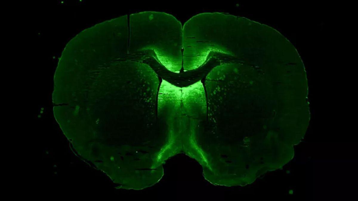 Células neuronales 3D cultivadas en microgravedad, que se utilizan para probar una terapia génica destinada al tratamiento de enfermedades neurológicas.