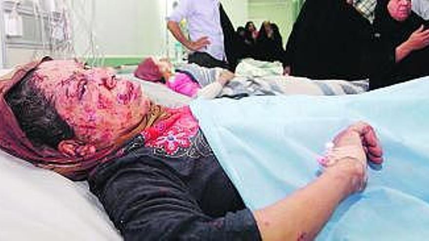 Una mujer herida en uno de los atentados, en un hospital de Faluya. / reuters