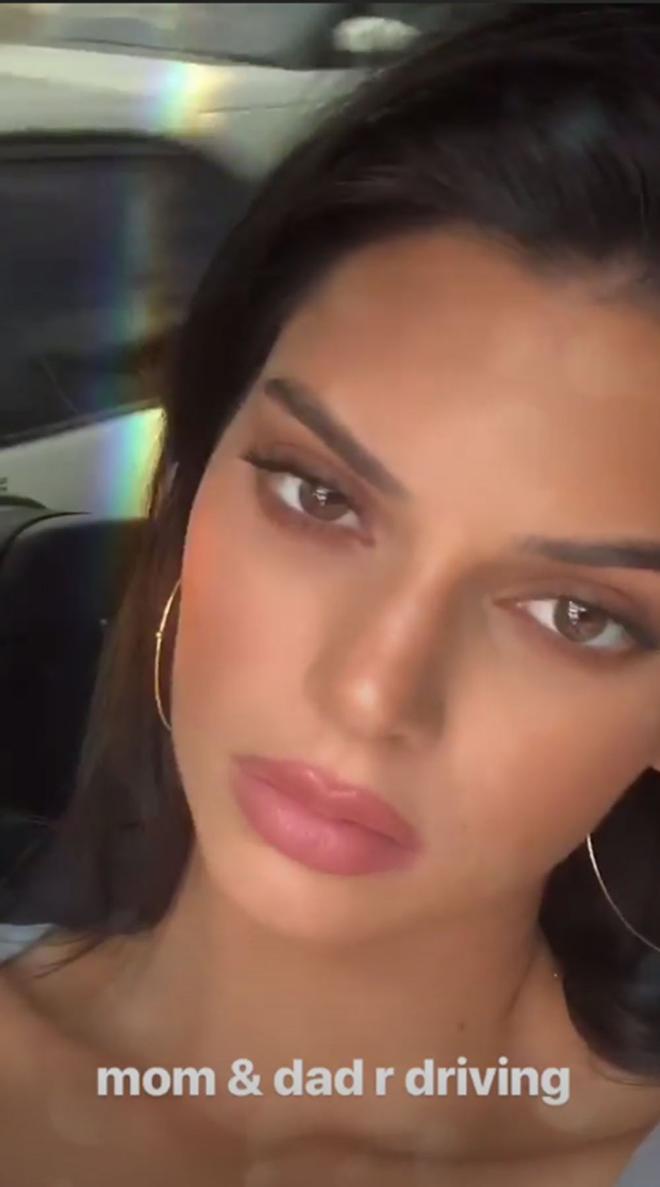 Rumores de labio operado de Kendall Jenner
