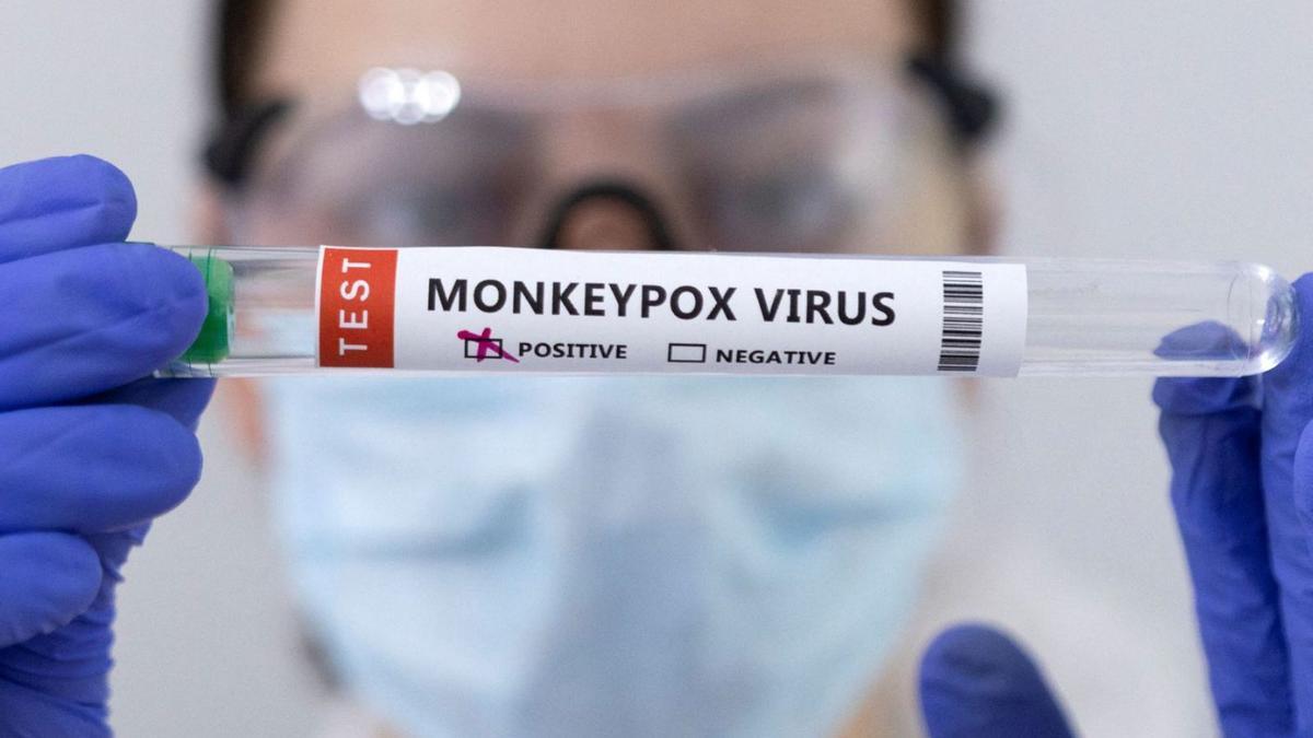 Un sanitario muestra un test positivo en viruela del mono. | | REUTERS