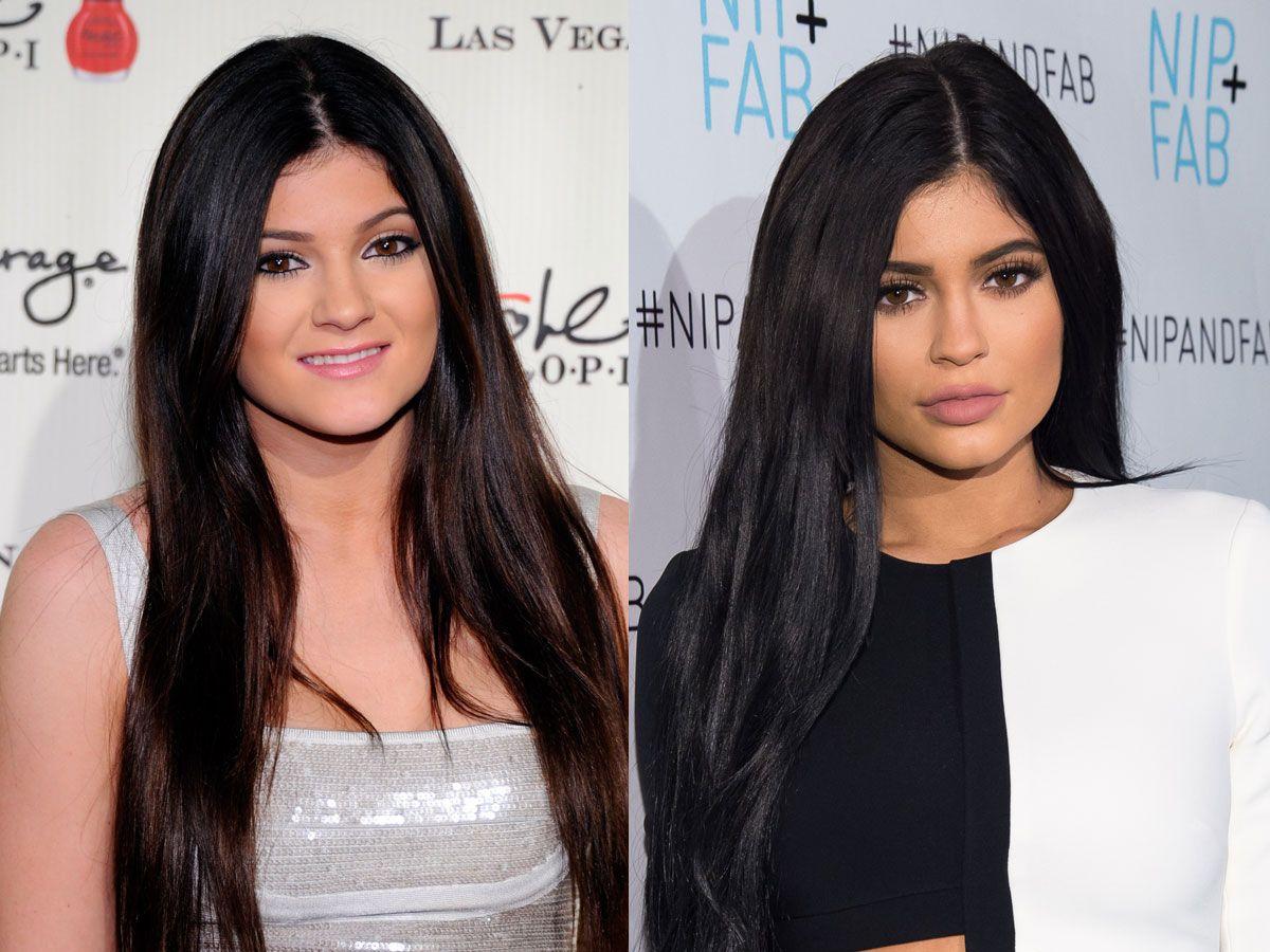 El antes y el después: Kylie Jenner