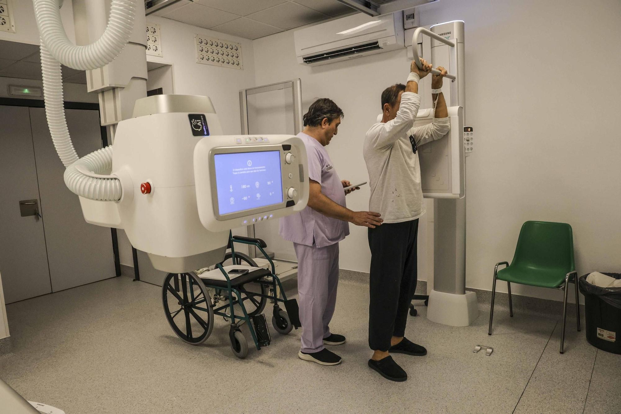 Alicante es el primer punto de España que hace radiografías con una cánara de inteligencia artificial