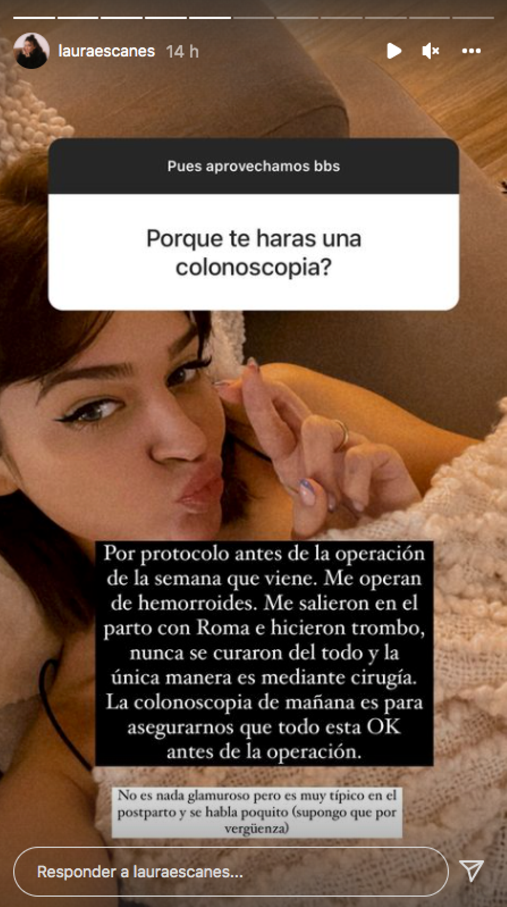 Laura Escanes habla de su operación de hemorroides