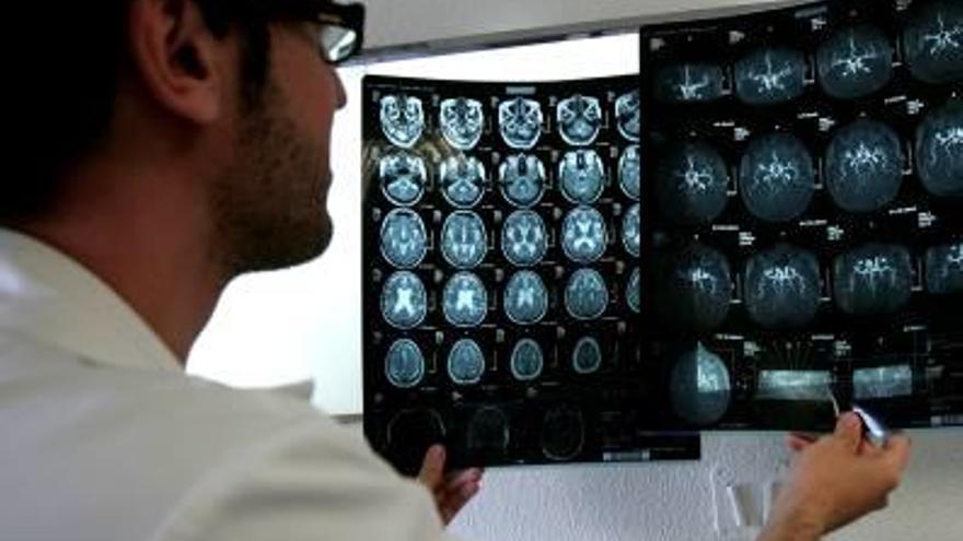 Sólo el 16% de los hospitales tienen neurólogos de guardia en Urgencias