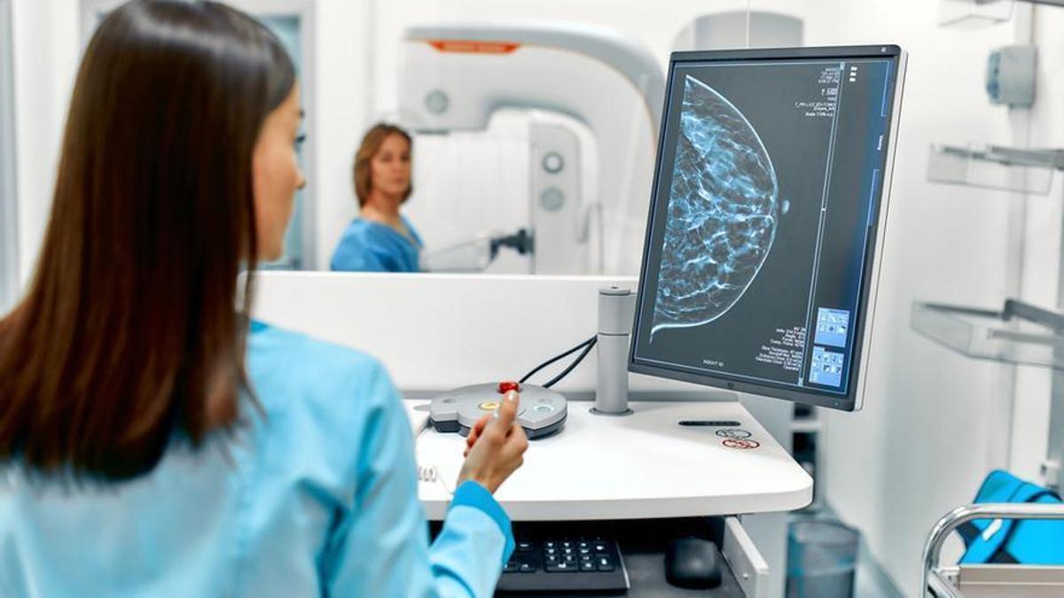 Estudio de un cáncer de mama.