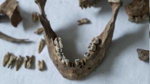 La mandíbula de uno de los esqueletos hallados en la fosa común de Celanova.