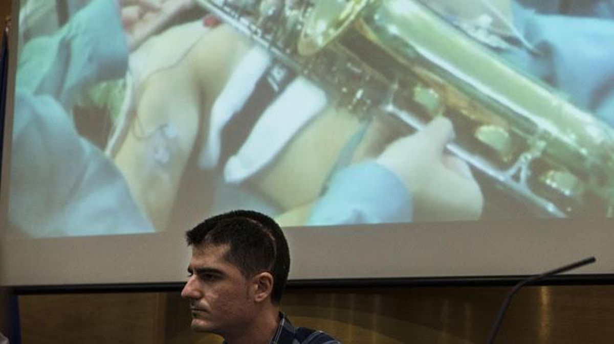 Carlos Aguilera va ser intervingut d’un tumor cerebral mentre tocava el saxo per comprovar les seves funcions motores.