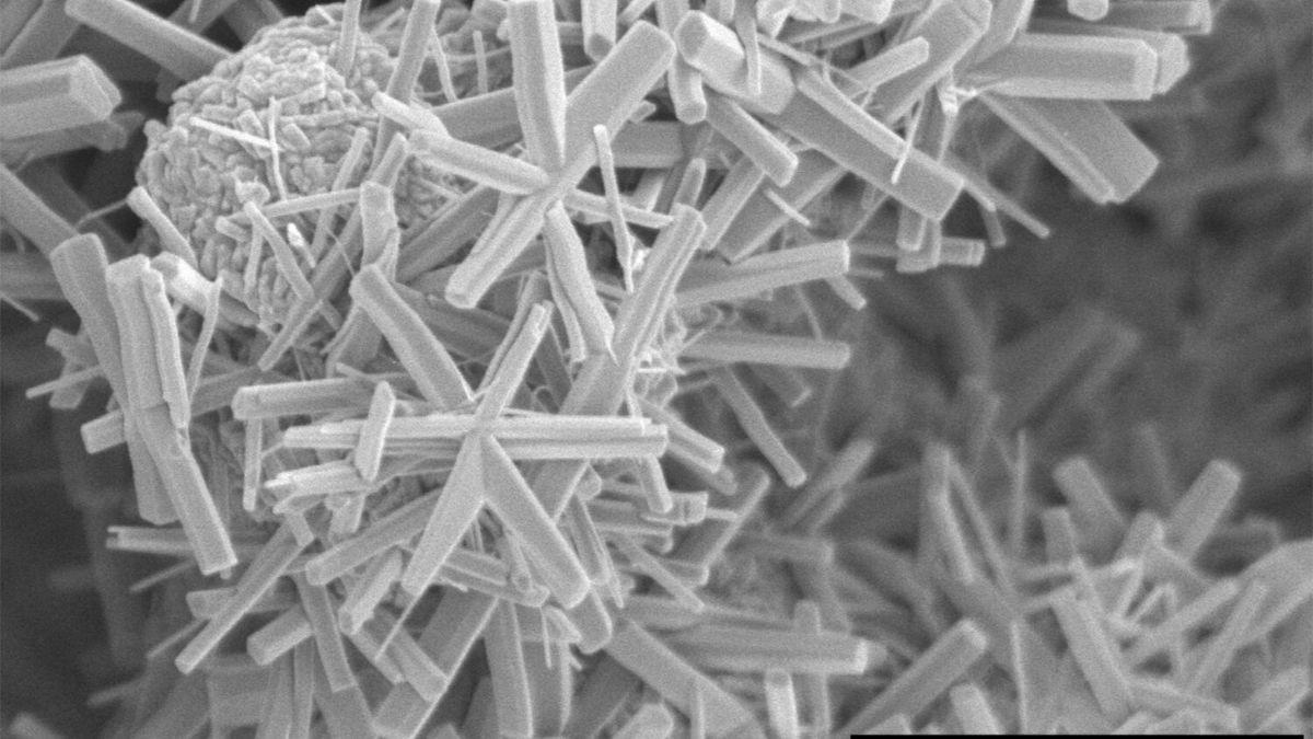 Una imagen de microscopio electrónico de barrido revela partículas de hidróxido de vanadilo (VOOH) con forma de estrellas.