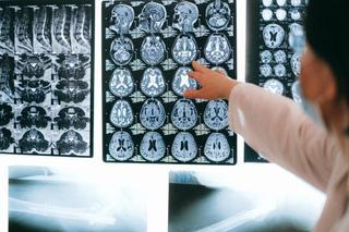 Los 7 consejos del neurólogo para mantener sano nuestro cerebro y evitar riesgos de ictus, Alzheimer...