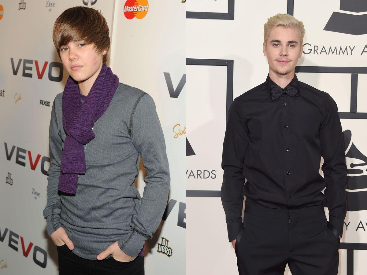 El antes y el después: Justin Bieber