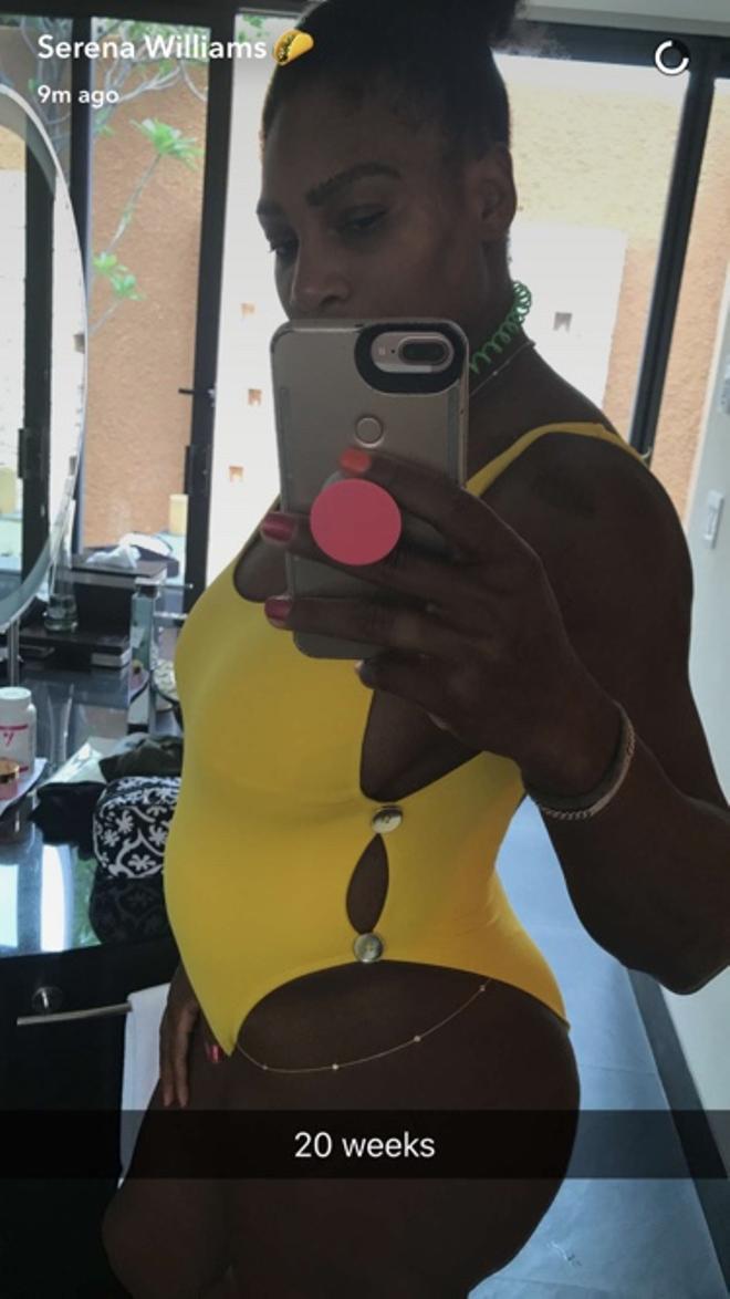 Serena Williams embarazada