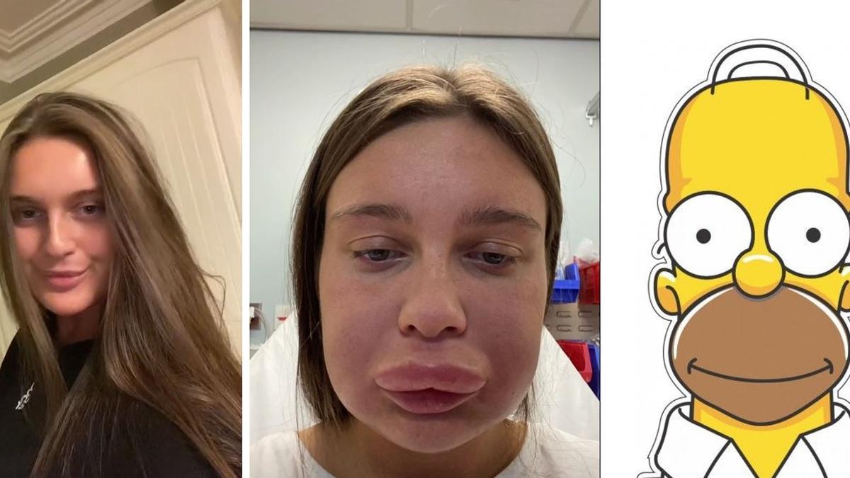 A la izquierda, Ruby ya recuperada; en el centro, tras la operación; y a la derecha, Homer Simpson