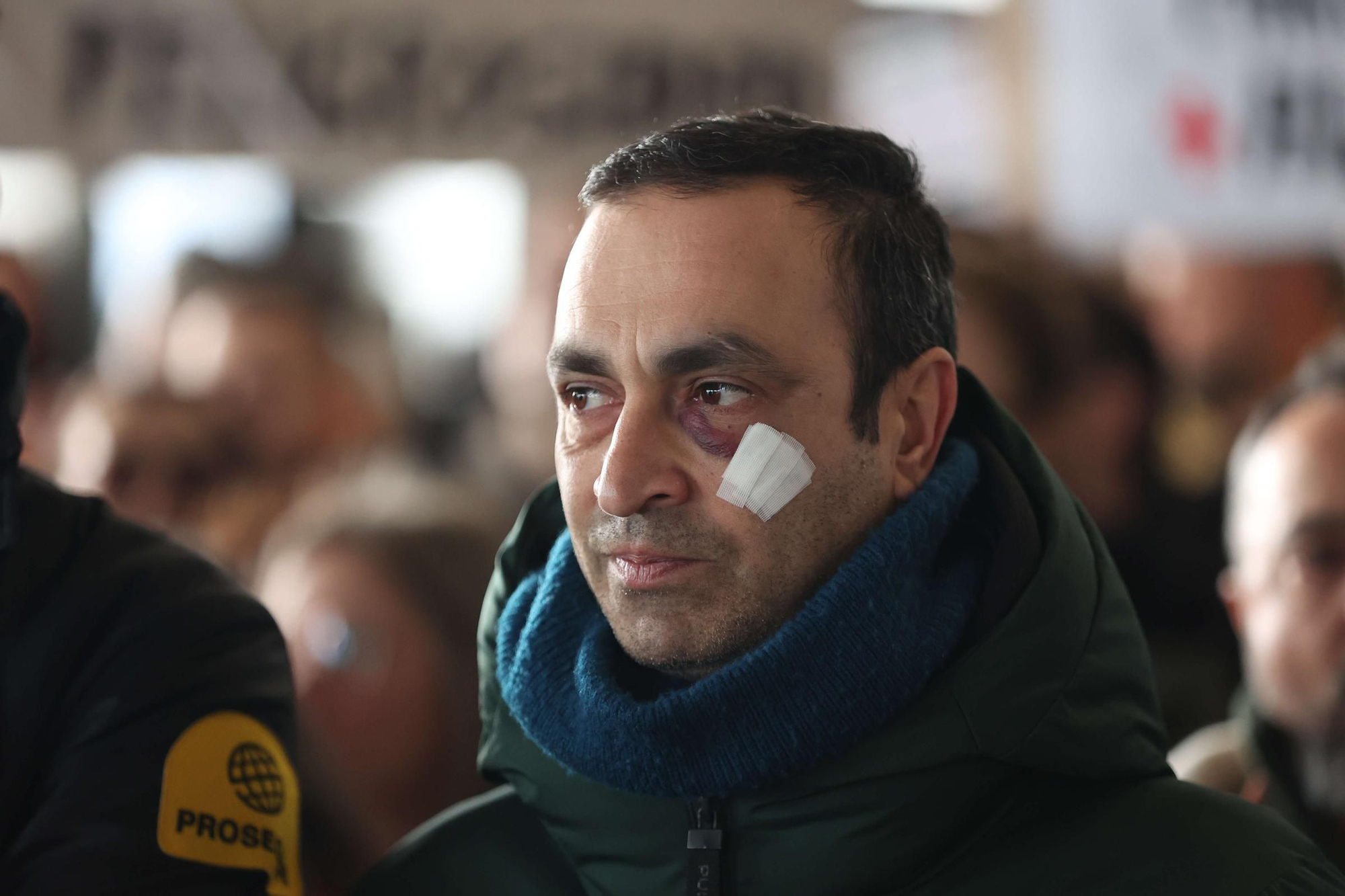 Protesta en el Chuac tras agredir un paciente con arma blanca a un enfermero y un vigilante