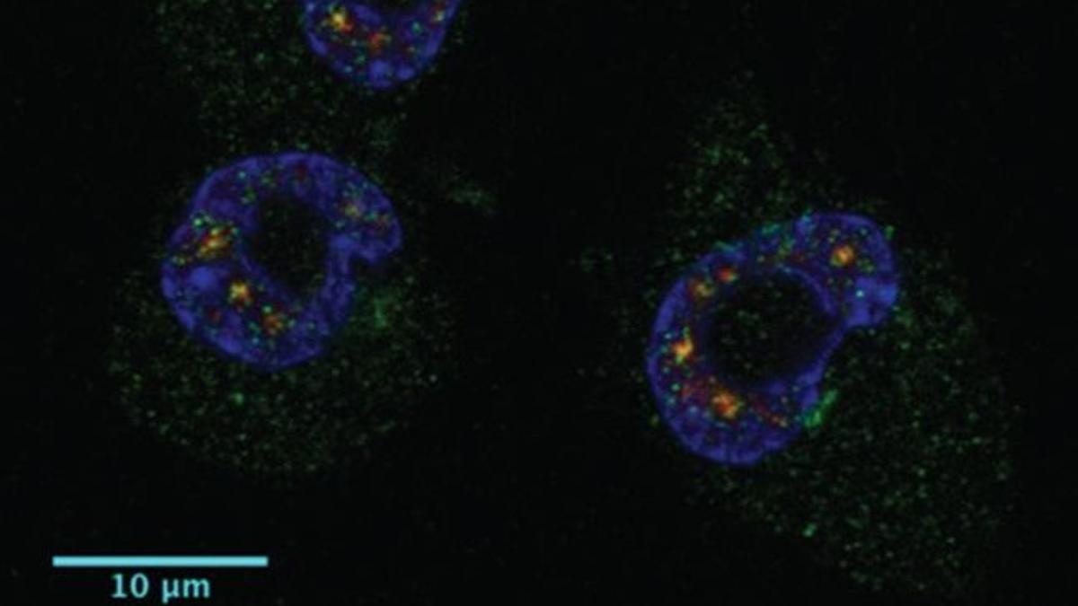 Cuatro células tumorales, con la localización de la proteína CPEB1 en color verde