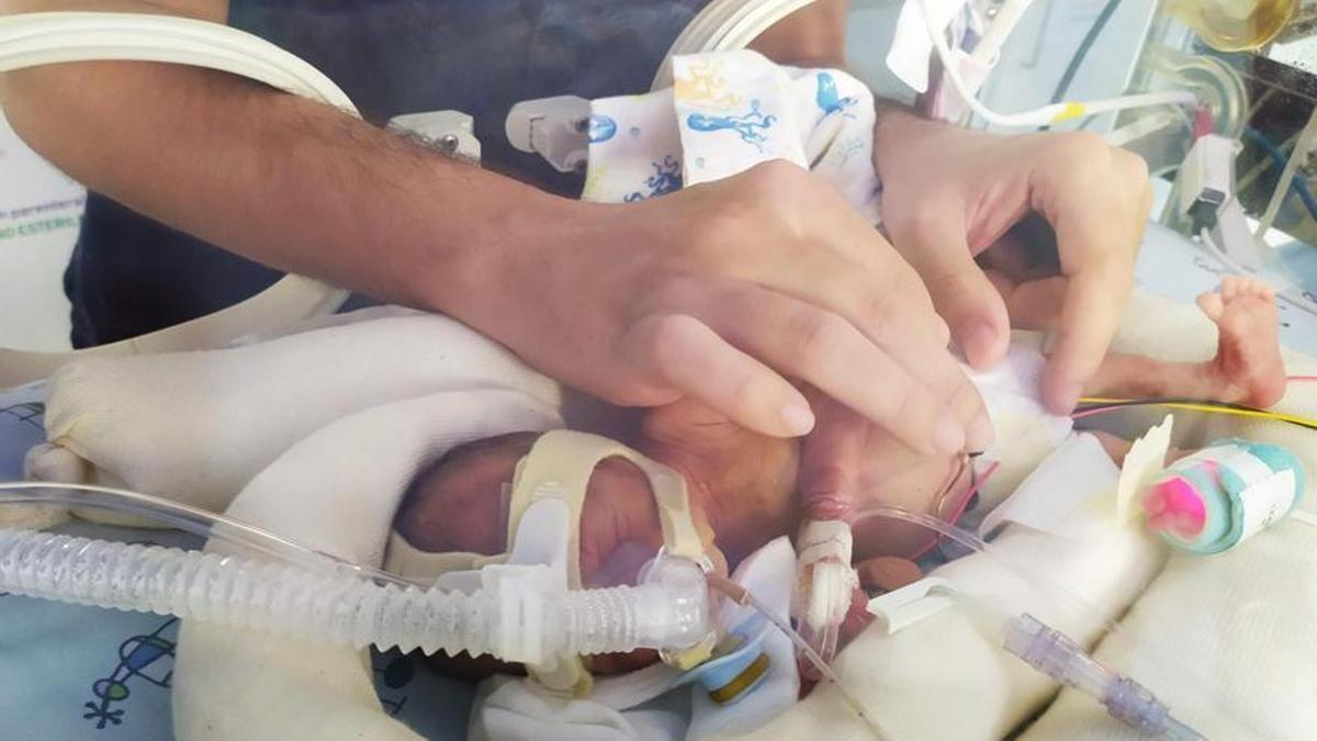 Elna nació en el hospital Clínic con solo 26 semanas de gestación.