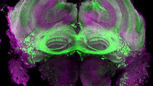 Vista microscópica del cerebro del zángano (violeta): las neuronas que pertenecen al circuito Fru, que controlan el comportamiento alimentario de los animales, están marcadas en verde.