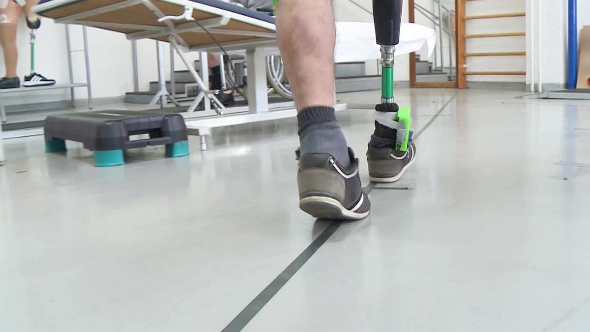 Un hombre logra caminar con una prótesis.