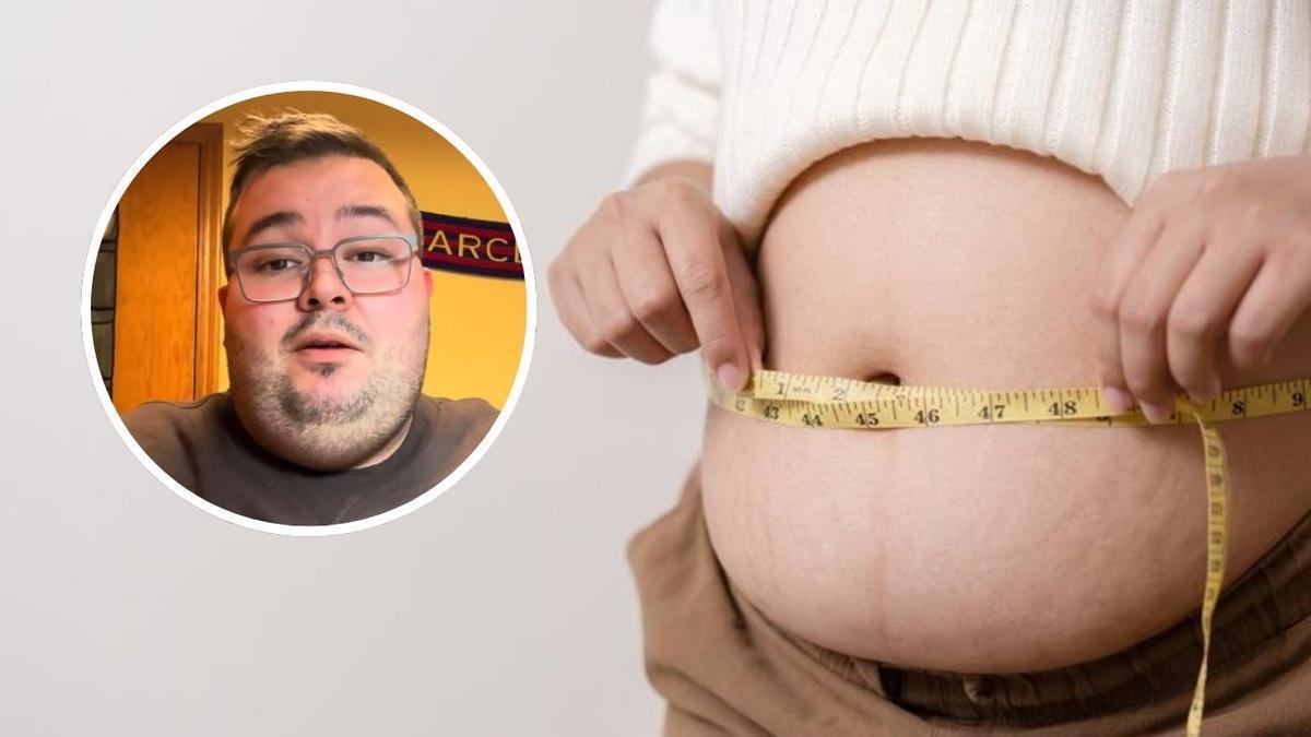 La obesidad en España supone un gasto de 130 mil millones de euros