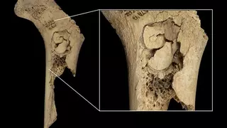 Despellejados, cocinados y devorados por grupos rivales: nuevo caso de canibalismo en Atapuerca de hace 5.5700 años