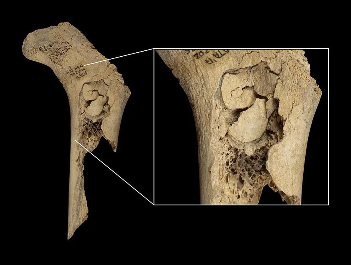 Fémur infantil con marcas de corte hallado en Atapuerca. Fémur infantil con marcas de corte hallado en Atapuerca.