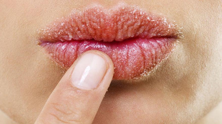 Para hidratar los labios agrietados utiliza bálsamos reparadores