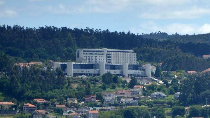 Vista del hospital Montecelo en Pontevedra. // Gustavo Santos