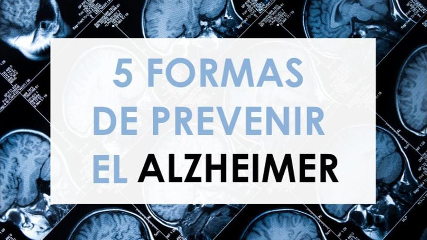 Cinco formas de prevenir el Alzheimer