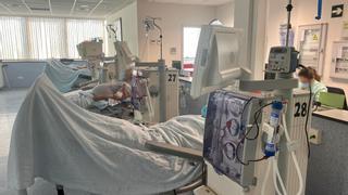 Sanidad heredó de Ribera 19 equipos de diálisis fuera de su vida útil y una planta de agua obsoleta en el Hospital de Torrevieja