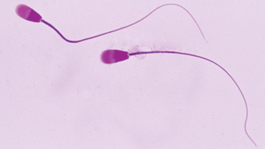 El 35% de las mujeres que se somete a inseminación artificial acude sin pareja a un banco de esperma