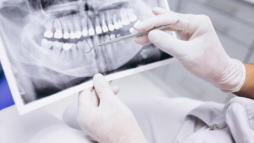 Las siete dudas más frecuentes sobre implantes dentales