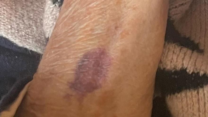 El PSIB exige explicaciones al IMAS por los supuestos malos tratos en una residencia de Marratxí